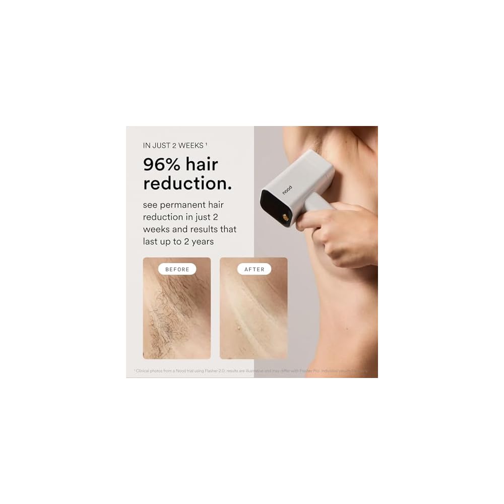 NOOD Flasher Pro IPL Laser-Haarentfernungsgerät mit Rotlichttherapie